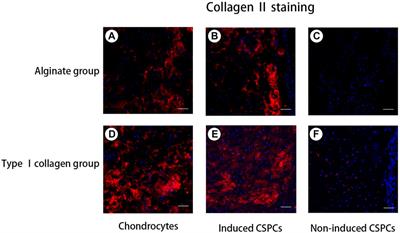 Comparative study of alginate and type I collagen as biomaterials for cartilage stem/progenitor cells to construct tissue-engineered cartilage in vivo